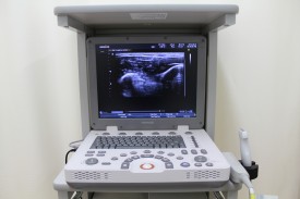 <span style="font-size:70%;">超音波観察装置「ＭｙＳｏｎｏＵ6」</span>